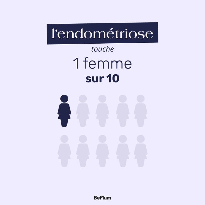 Endométriose : traitement et hygiène de vie