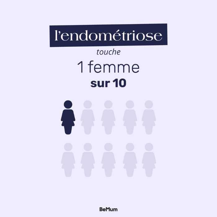 Endométriose : traitement et hygiène de vie