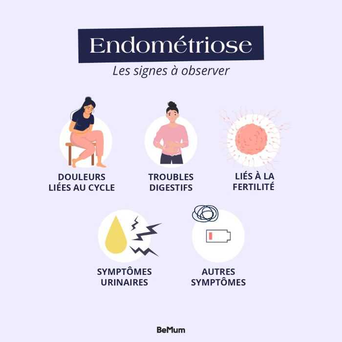 Les symptômes de l’endométriose